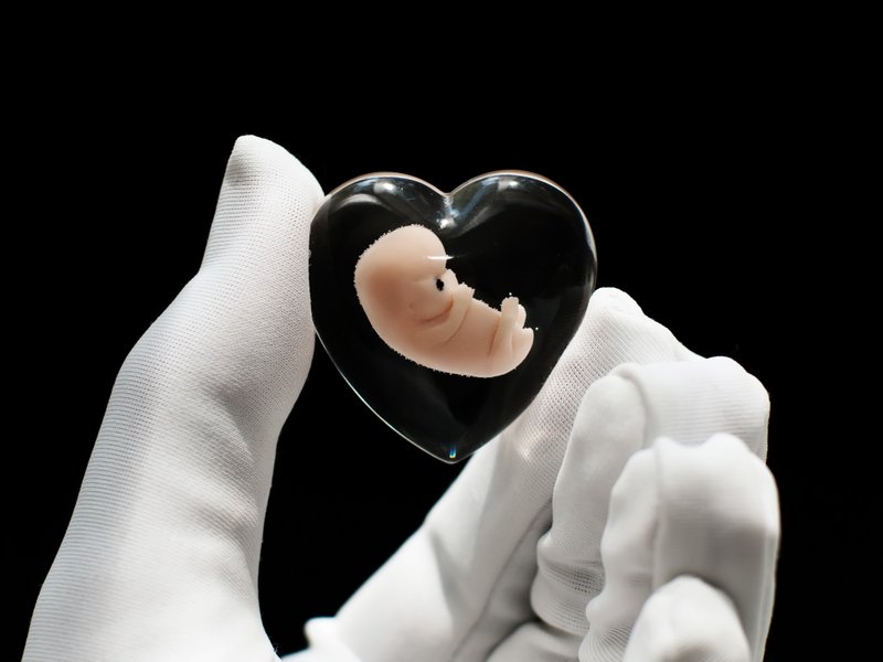 Embryo 8 weeks, 8 weeks pregnant, Sculpture cast in resin - 公仔/玩偶 - 樹脂 