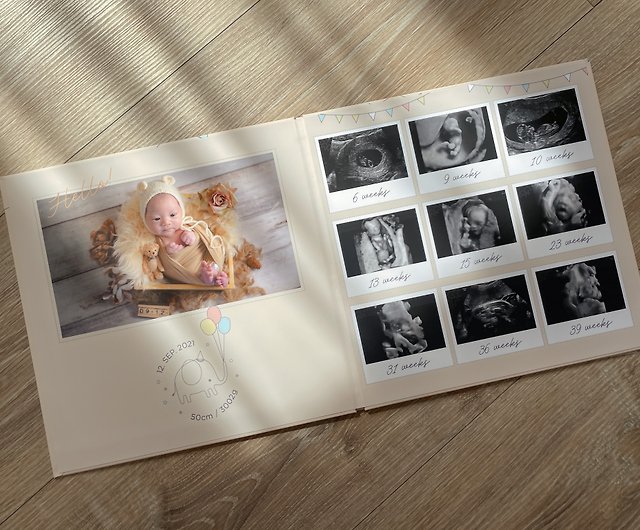 Animal Party (Pink Apricot)-Pregnancy Baby Album, Pregnant and Newborn  Photo/Ultrasound Photo